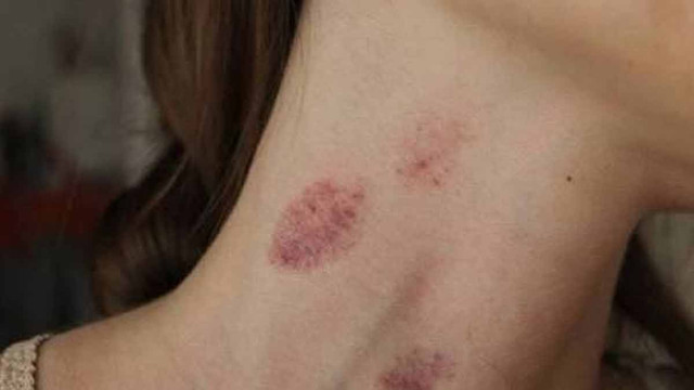 hickey-main