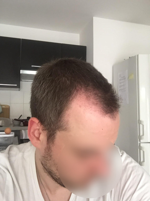 M2 4