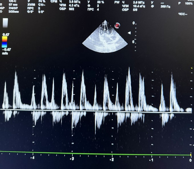 Screenshot 36