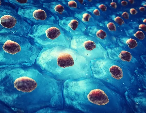 New Drug Candidate Shows Promise for Huntington's Disease