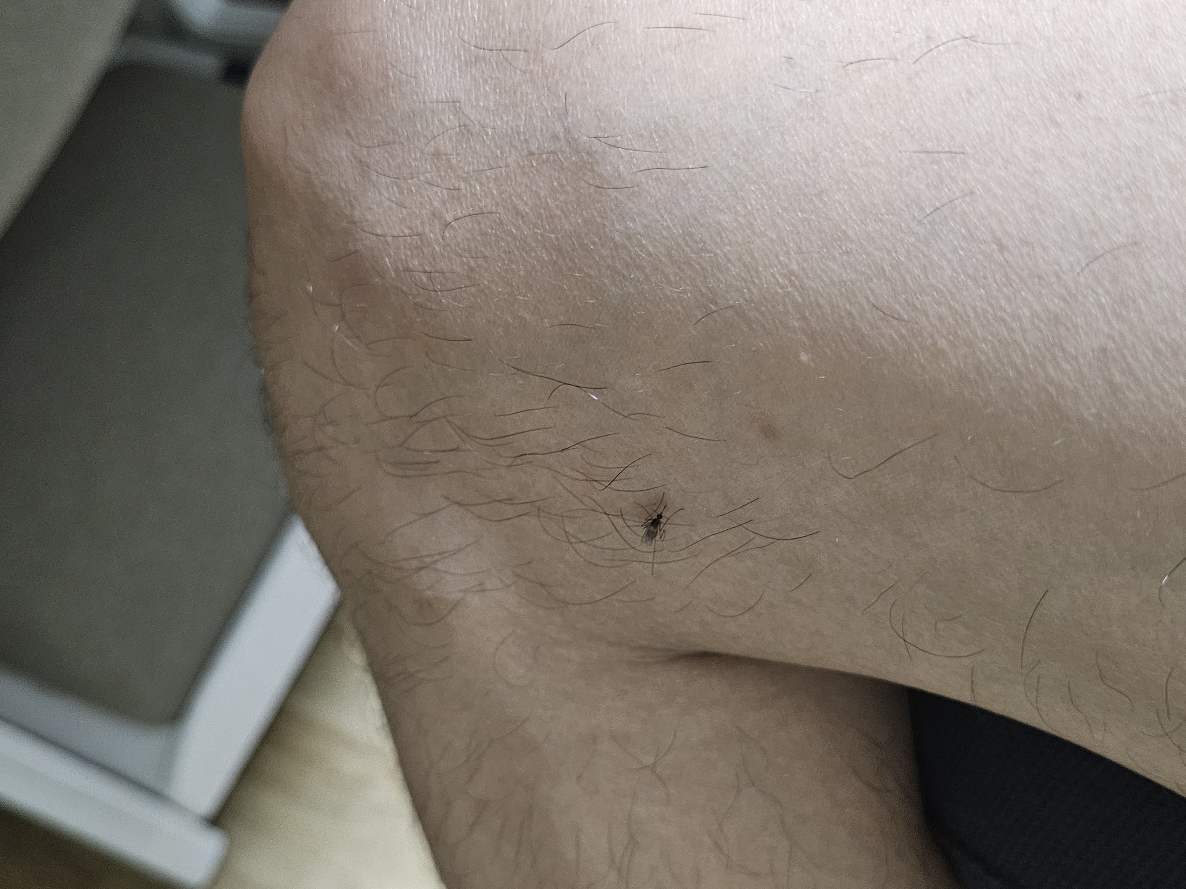 모기 실제 피 빨고 있는 현장 사진