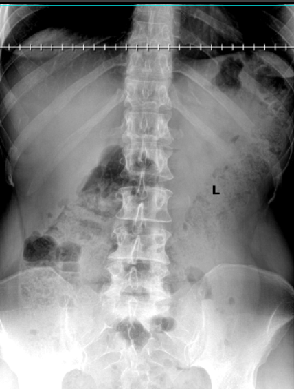 xray5.png