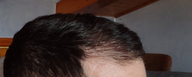 3-MESES-POST-3
