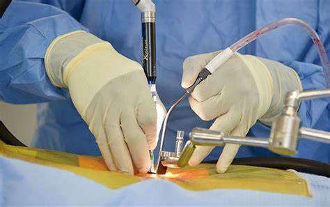 Minimally Invasive Spine Surgery: Why To Consider And Whether You’re An Ideal Candidate