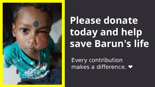 Help 3-Year-Old Barun Roy Fight Cancer - Image 2