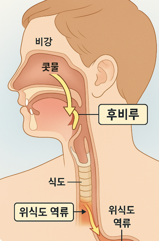 가래 없애는 방법을 찾기 전 원인