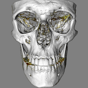 skull front.png