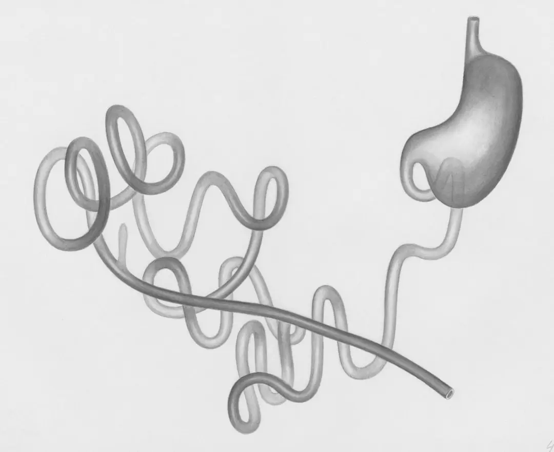 The Mental Toll of Gut Health