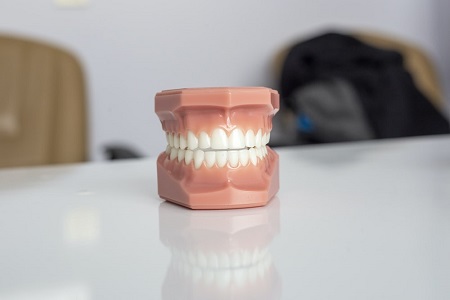 Wisdom-Teeth-Removal-Sydney