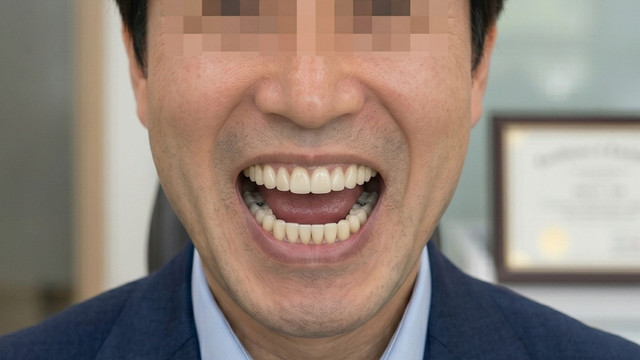 수술 후