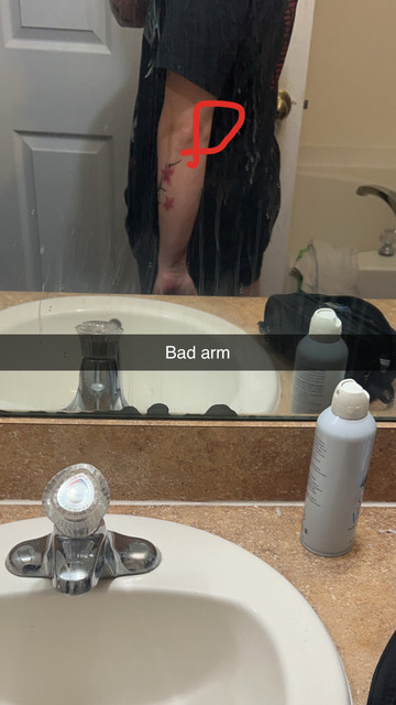 bad-arm