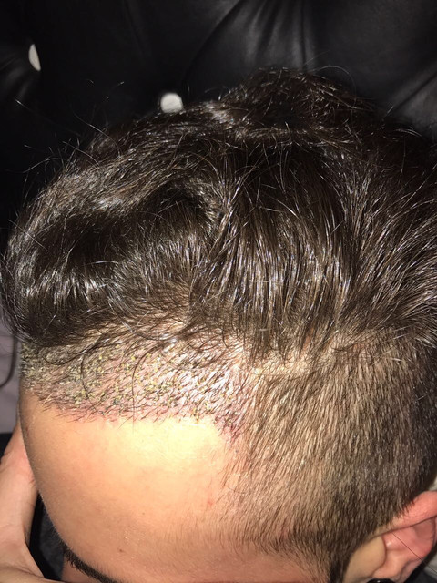 IMG 3422