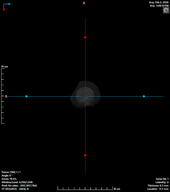 gif axial.gif