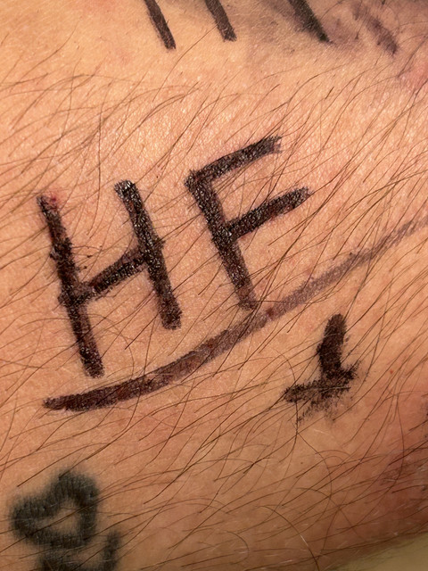 IMG-2335