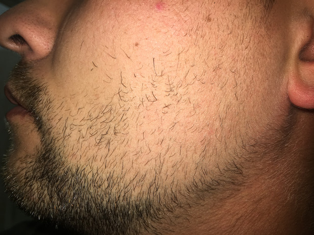 IMG 1987