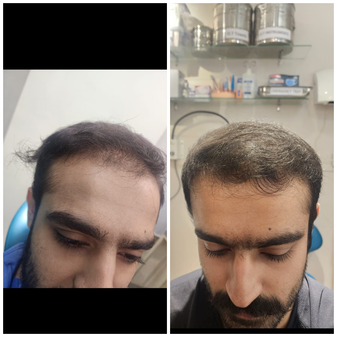 Real patient result