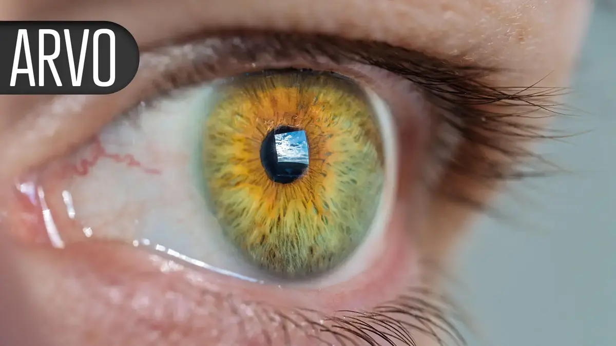 New Implant Helps Preserve Vision in Wet AMD