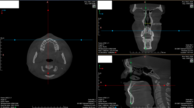 mpr measurements 8.png