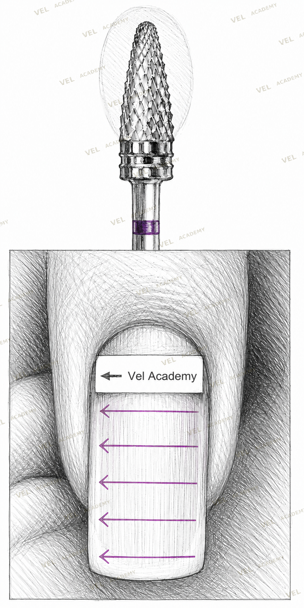 Nail plate surface condition after gel removal showing assessment areas