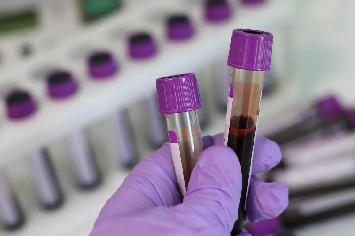Test de sânge revoluționar pentru depistarea cancerului pulmonar