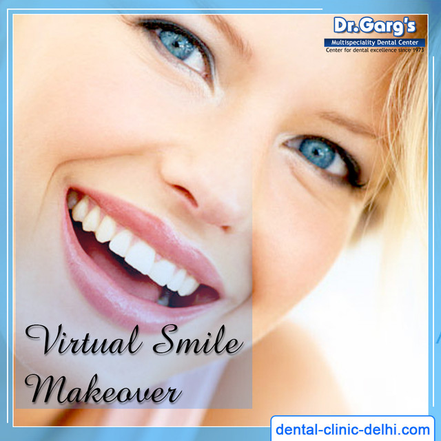 Dr. Garg’s Multispeciality Dental Centre is the best choice for affordable virtual smile makeover in Delhi through digital imaging techniques. The images show how the smile might look after the surgery; it helps to decide the way and limits of dental and facial correction. http://www.dental-clinic-delhi.com/virtual-smile-makeover.html