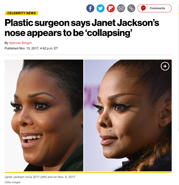 nose-collapsing