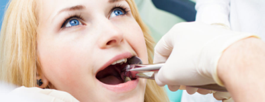 Wisdom-Teeth-Cost