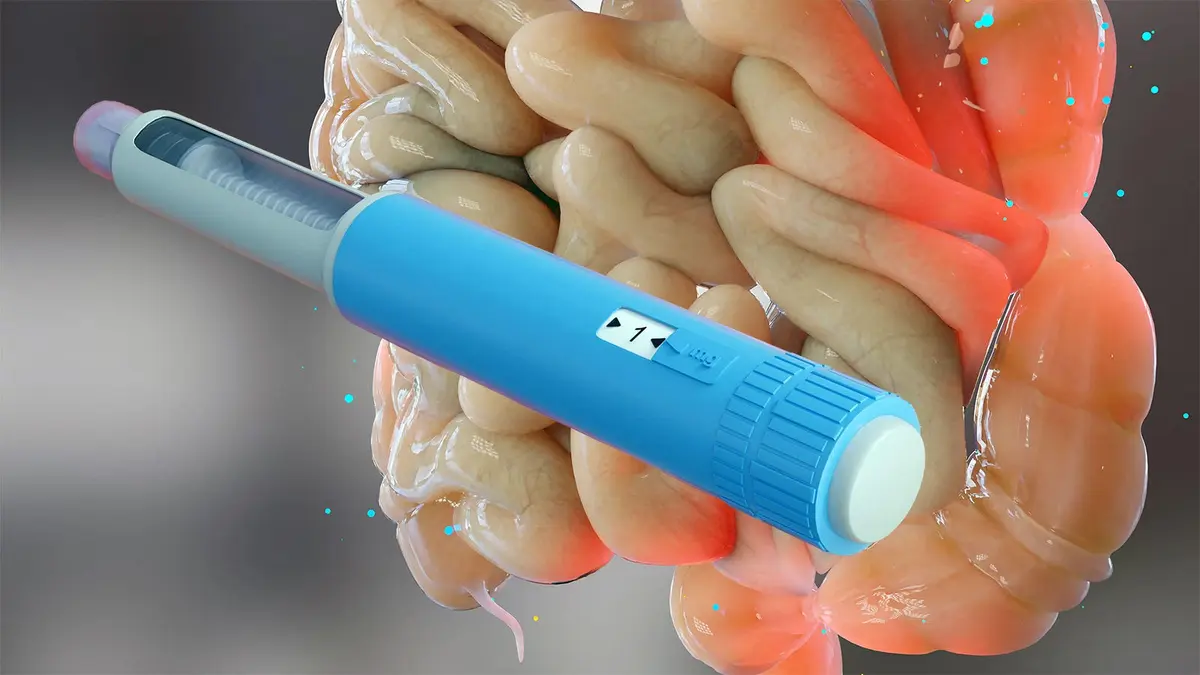 New Hope for IBD Patients with Weight-Loss Drugs