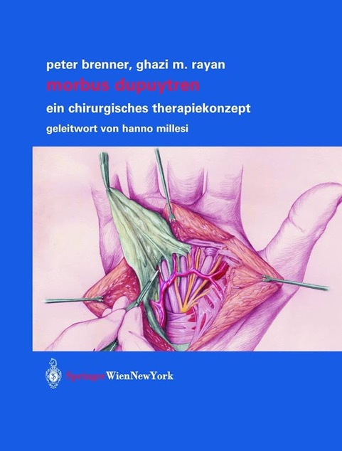 Morbus Dupuytren (German) cover