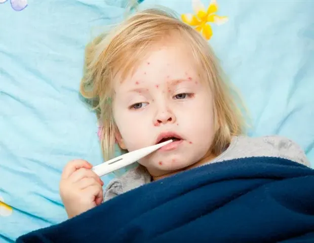 Oral Antiviral Targets Measles and Croup Syndrome