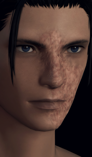 Face Scar32.png