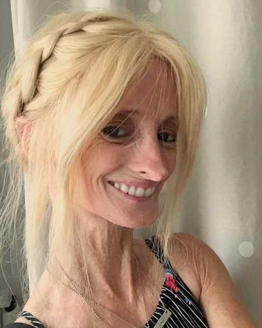 Progeria-Barbie