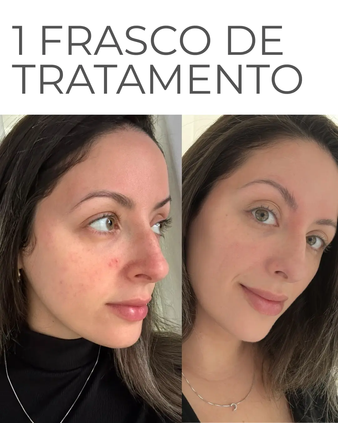 Ellen, 31 anos