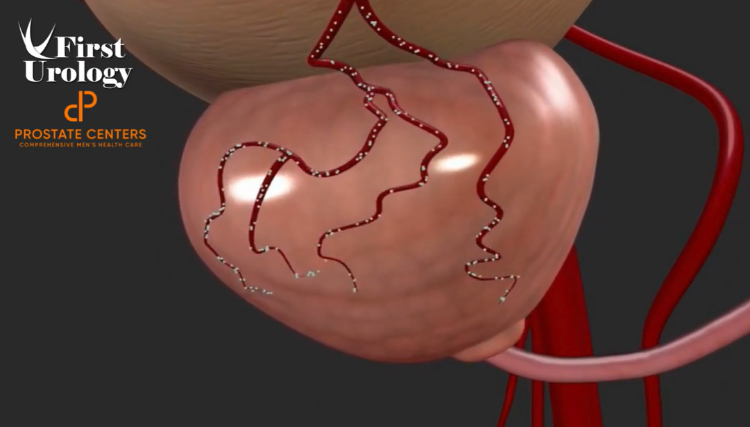 Preview thumbnail for PAE animation video