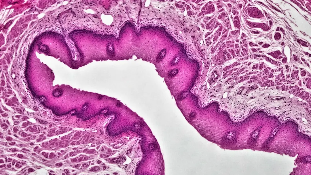Tranziții de stare microgliale dictă Alzheimer