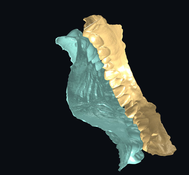 occlusion 7.png