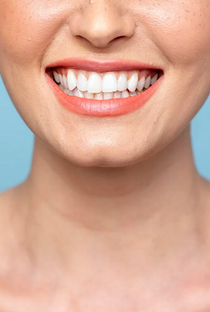 Affordable-Wisdom-teeth-Removal-Sydney