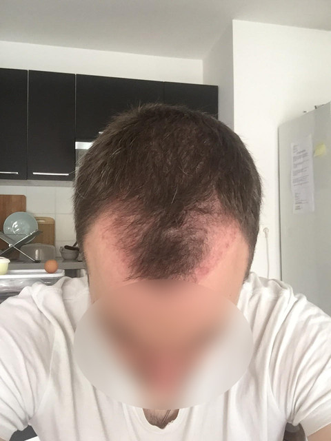 M2 2