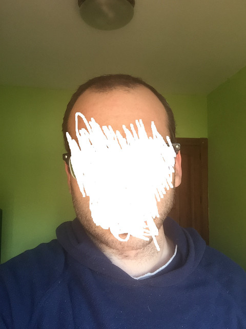 calva1