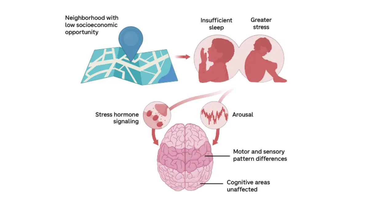 Socioeconomic Factors Embedded in Children's Brains