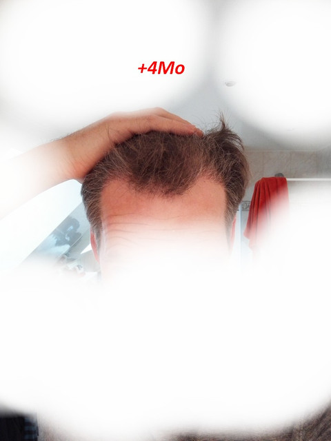 4Mo-1.jpg