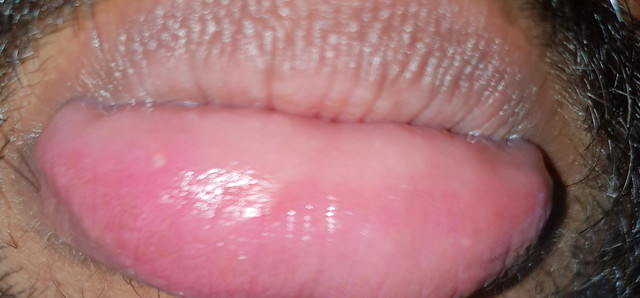 20181201-100938