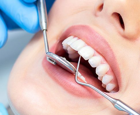 علاج حساسية الاسنان