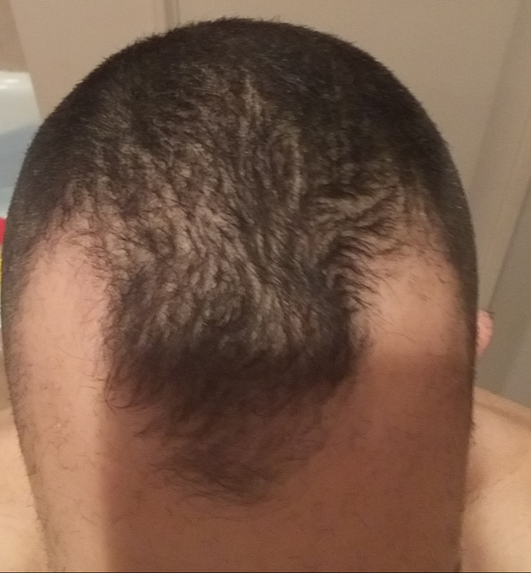 antes