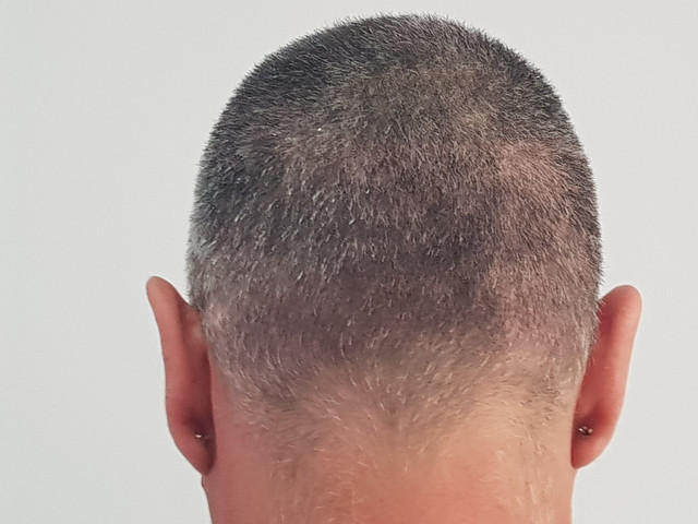 15DIAS2