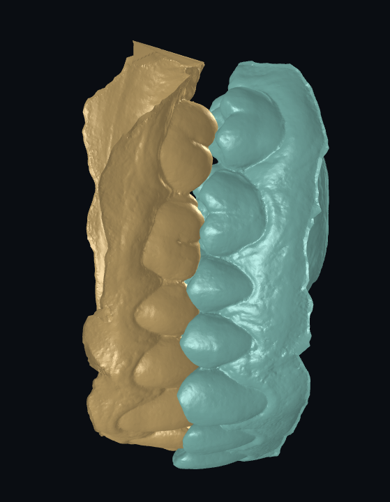 occlusion 3.png