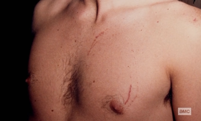 RCNips