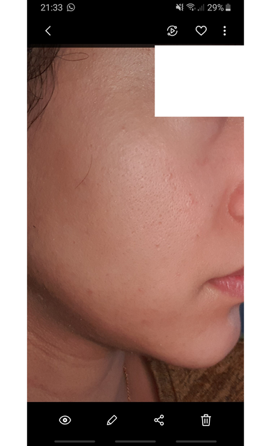 Skin-2