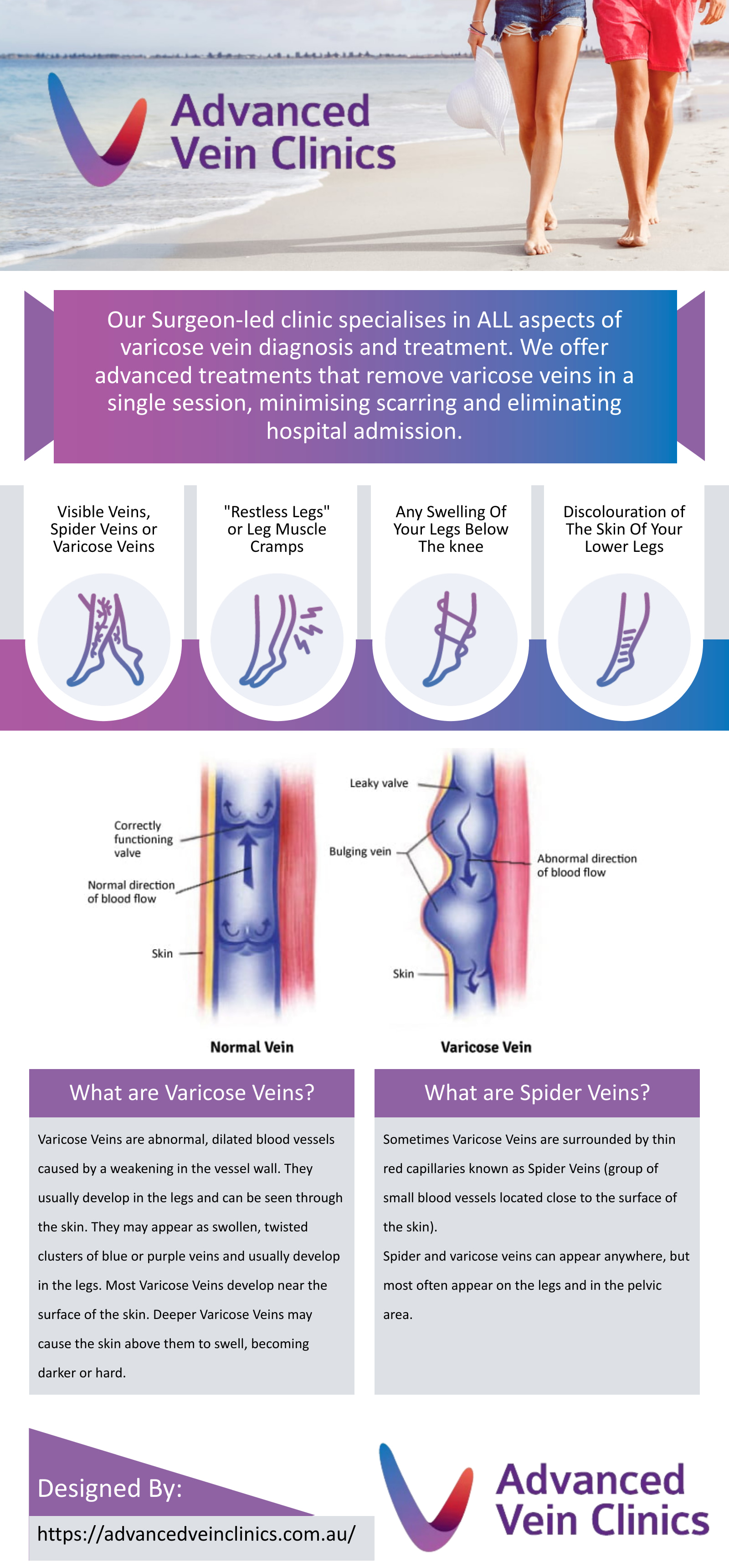 Advanced-Vein-Clinics