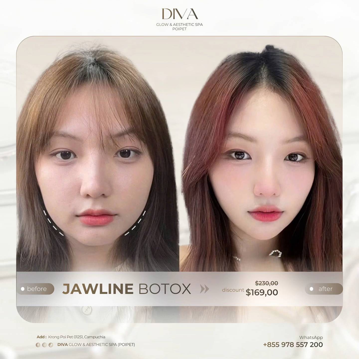 DIVA Skin Clinic Poipet